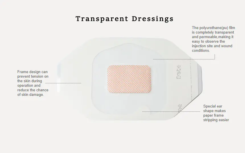 Application of transparent dressing in clinical nursing work