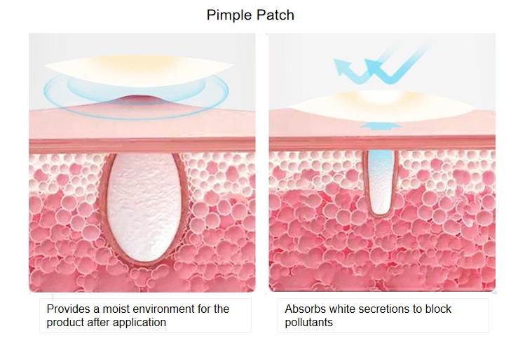 pimple patch