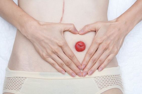 Caring for people with stoma