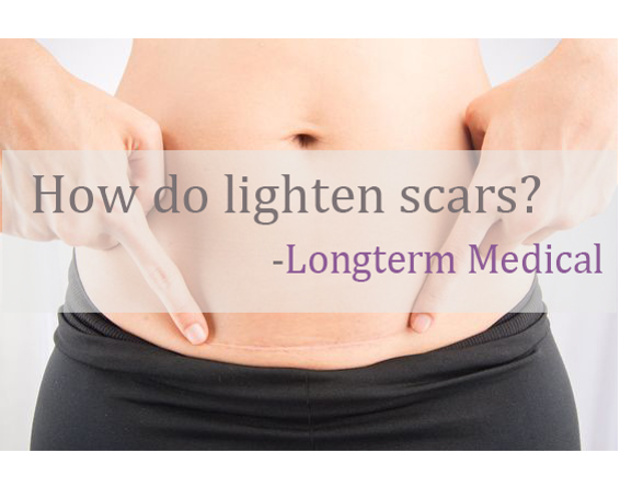 How do lighten scars?