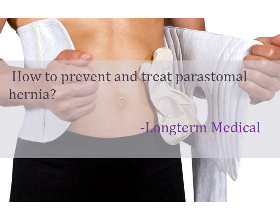How to prevent and treat parastomal hernia? 