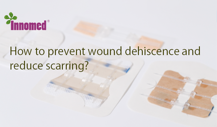 How to prevent wound dehiscence and reduce scarring?