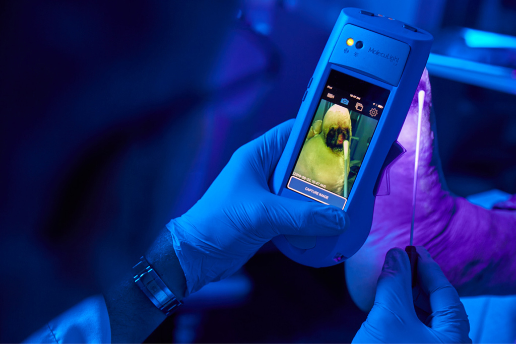 Wound Bacterial Burden Testing Devices