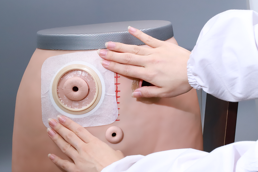  Colostomy Care Market