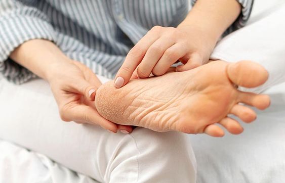 How to prevent and care for corns and calluses on feet?