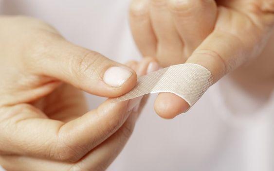 How to treat small wounds without leaving scars (1)