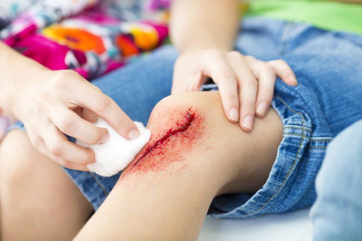 Should wound dressings be changed every day to keep them clean?