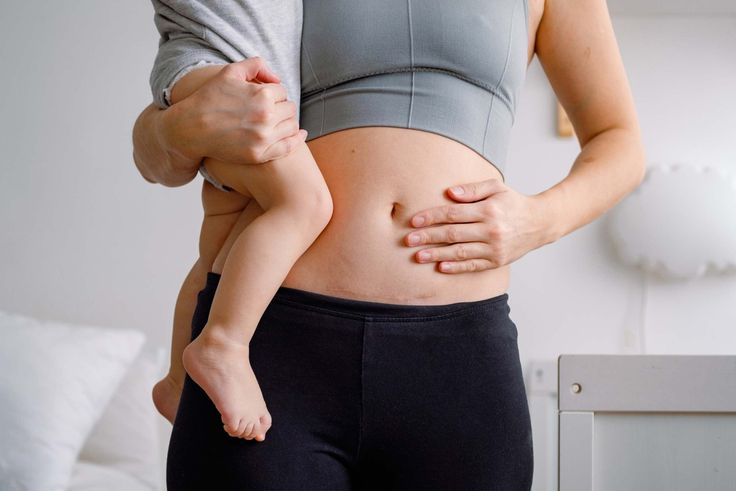 How to properly care for cesarean section scar hyperplasia?