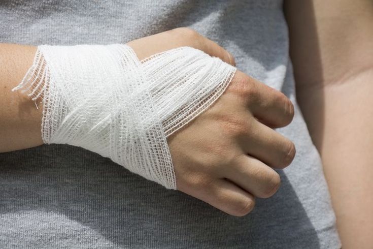 First aid treatment for hand injuries