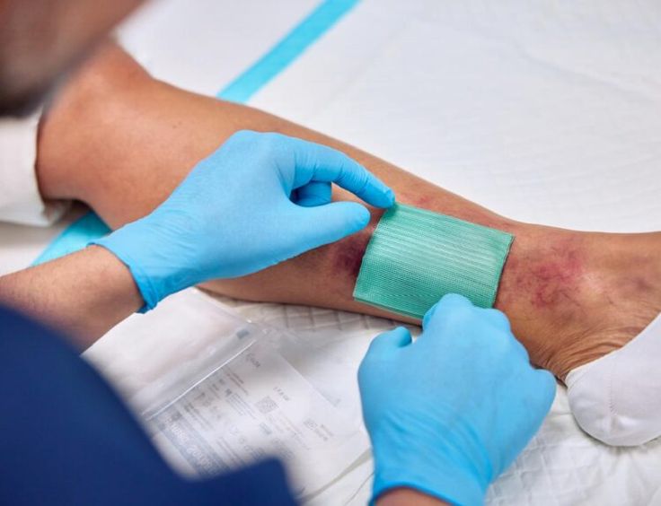 Postoperative wound care in summer