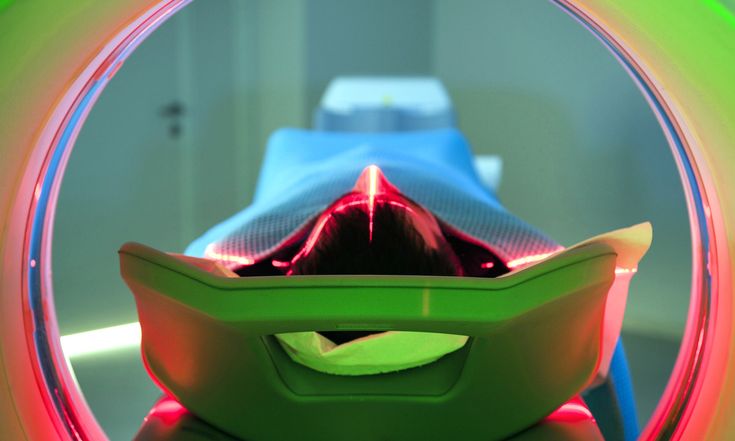 Skin irritation during radiation therapy