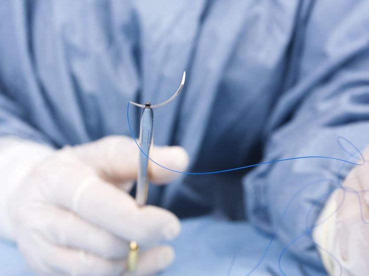 If the scars from surgical sutures become red and swollen?