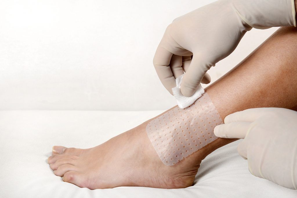 How to choose appropriate dressing based on wound characteristics?