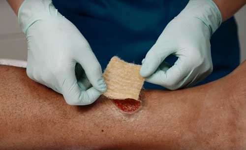 The correct way to deal with black scabs on wounds