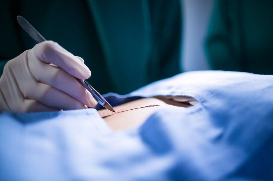 How long does it take for a sinus tract to heal after surgery?