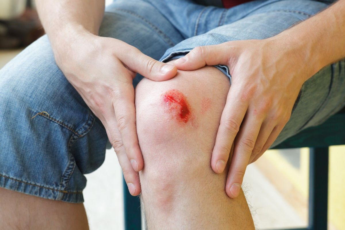 The role of wound exudate