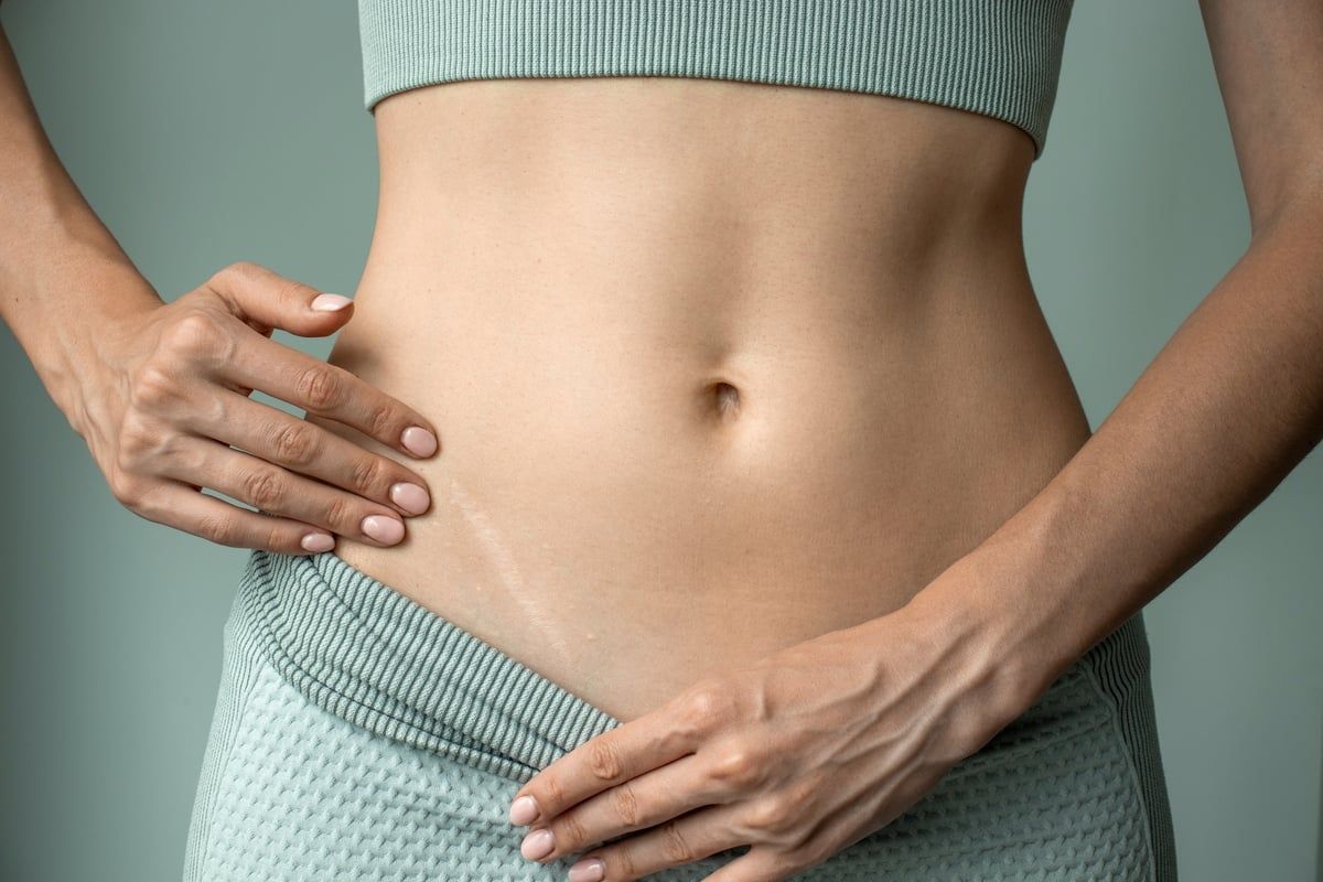 Cesarean section wound recovery time