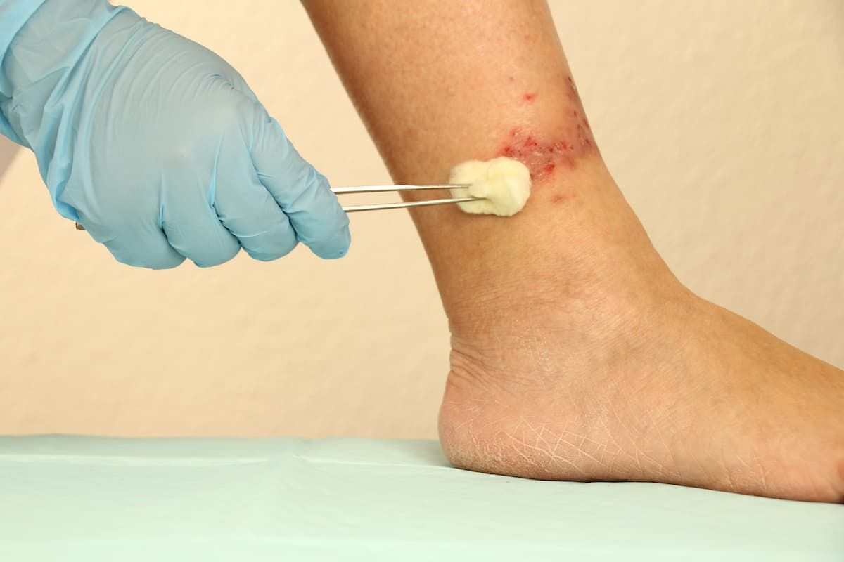 How to correctly assess the wound condition?