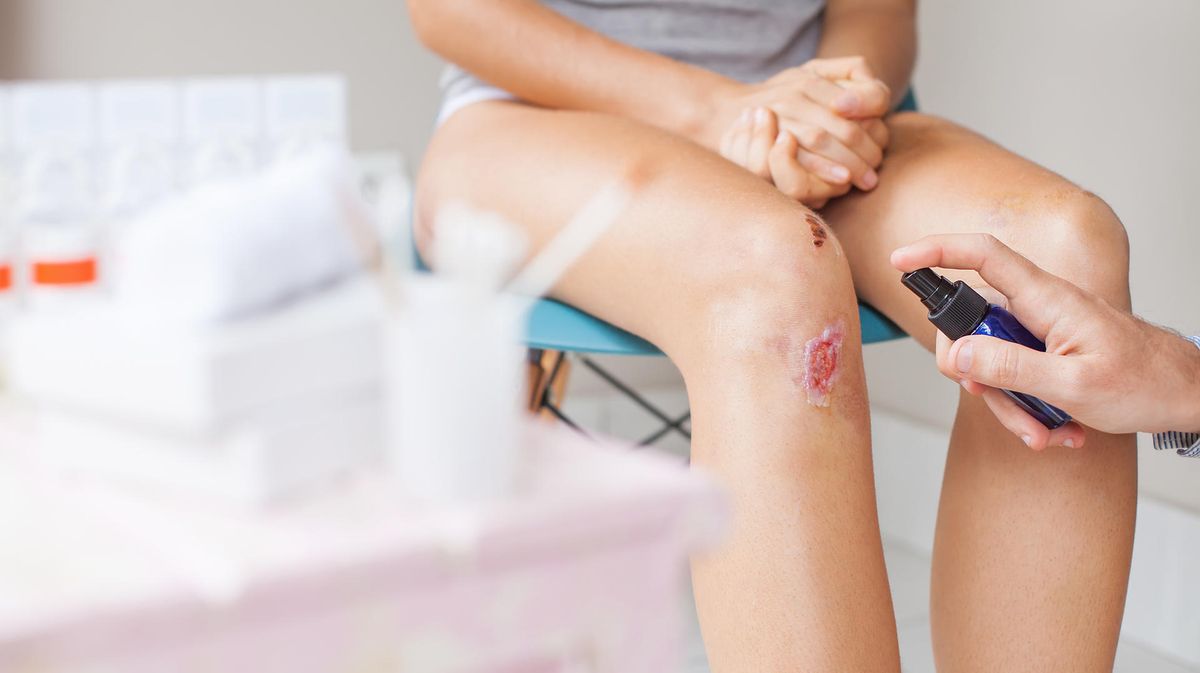 How to prevent scar formation in autumn