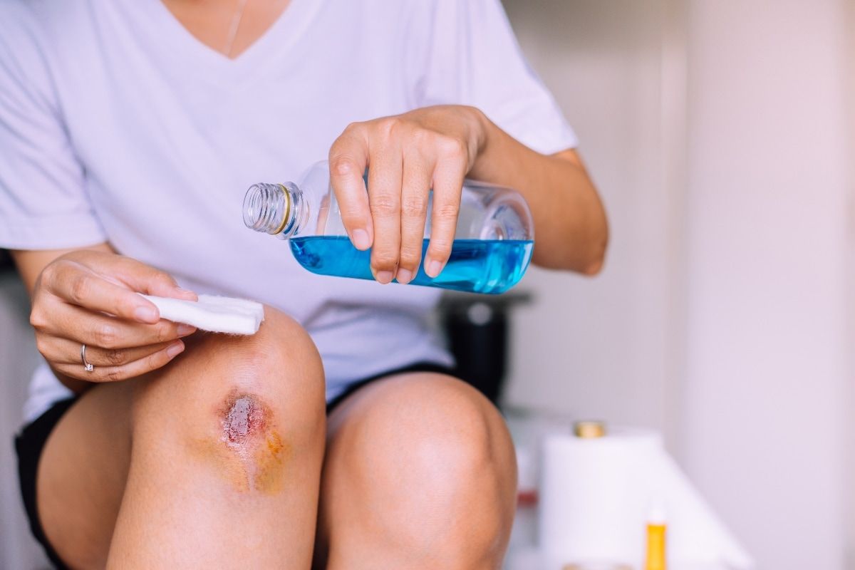 The correct way to treat children's scrapes and scratches
