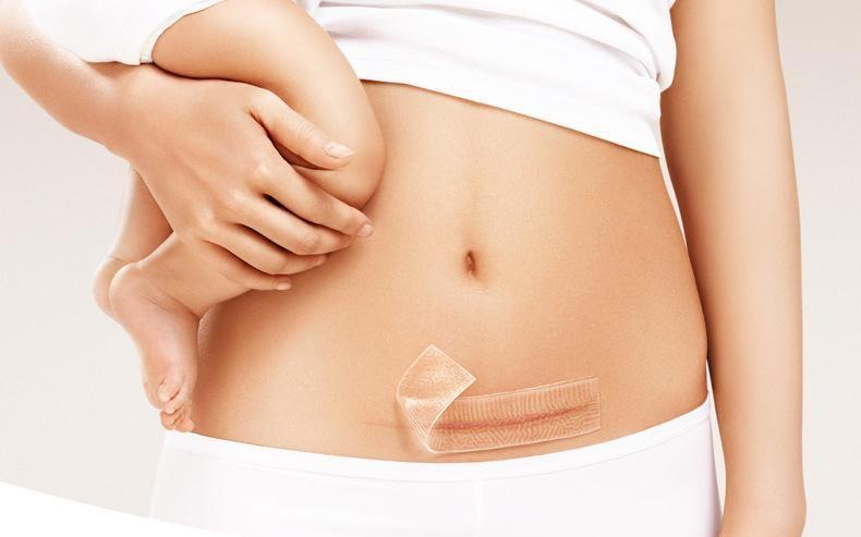 Four common types of scars