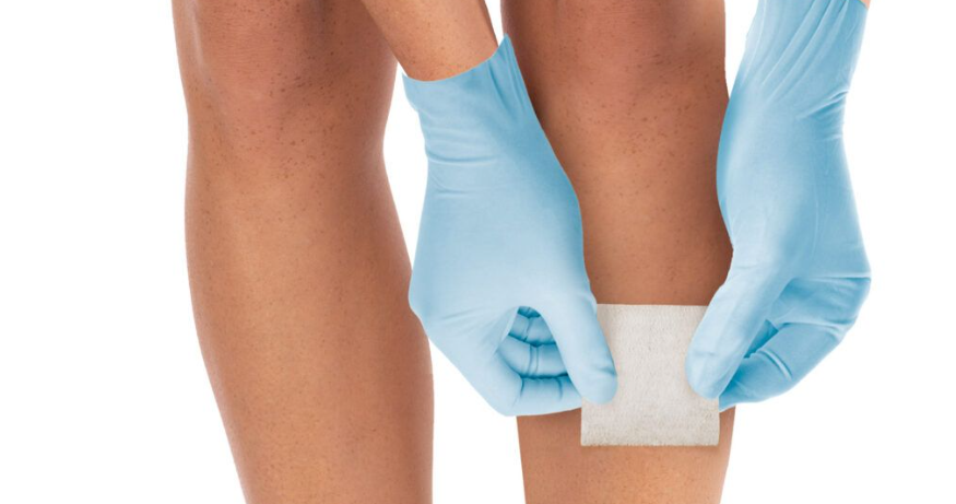 Common Questions and Answers about Calcium Alginate Dressings