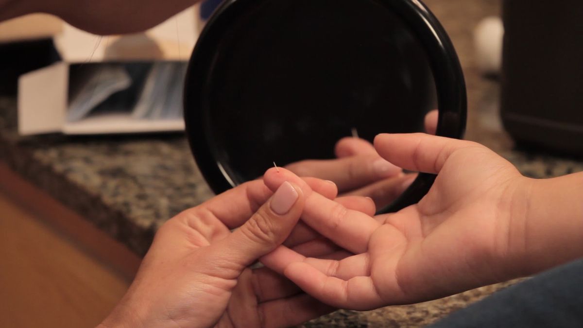 Scientific treatment steps for splinter wounds