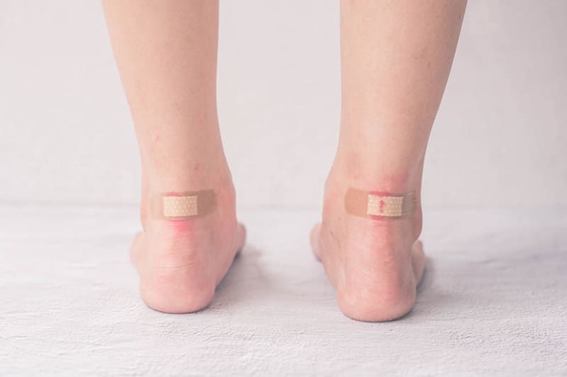 A serious infection incident caused by new shoes