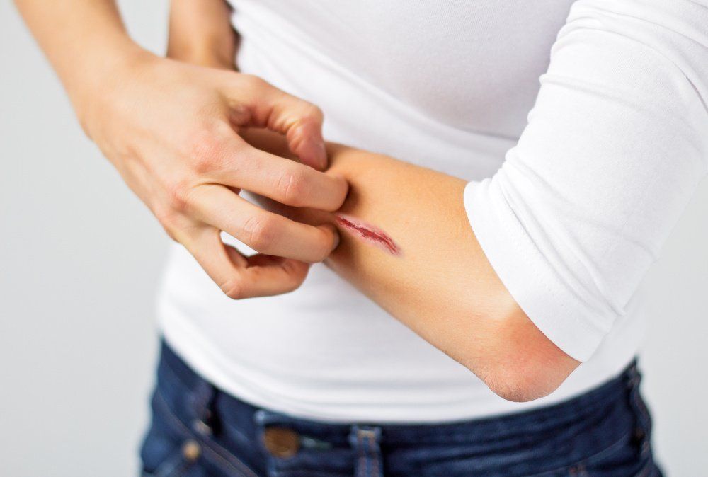 How can I relieve itching under a dressing on a wound ?