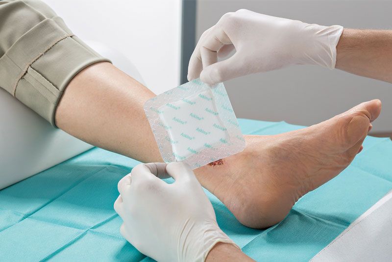 How to monitor diabetic foot wounds at home?