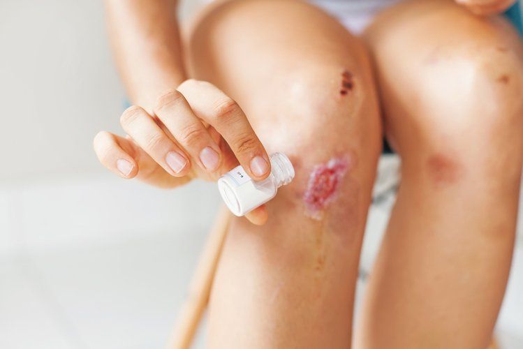 How should wounds of different colors be treated?