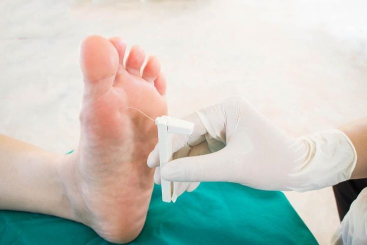 Global genomic studies reveal high diversity of drug-resistant Escherichia coli in diabetic foot infections.