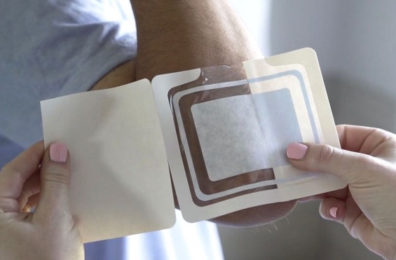 What are the uses of silver ion dressings ?