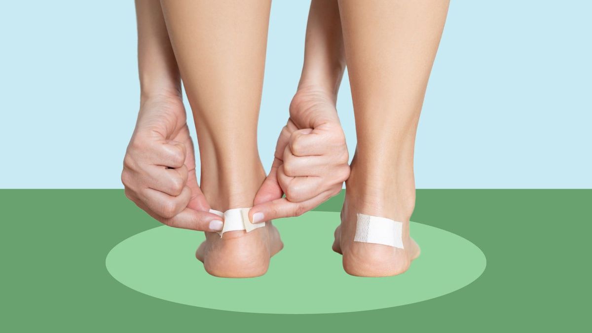 Should I pop the blisters? If I do, what kind of dressing should I apply?