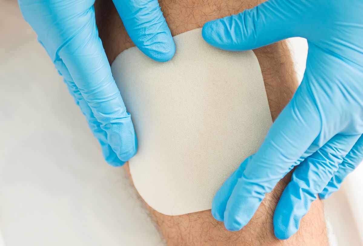 How to properly cut hydrocolloid dressings to fit a wound?