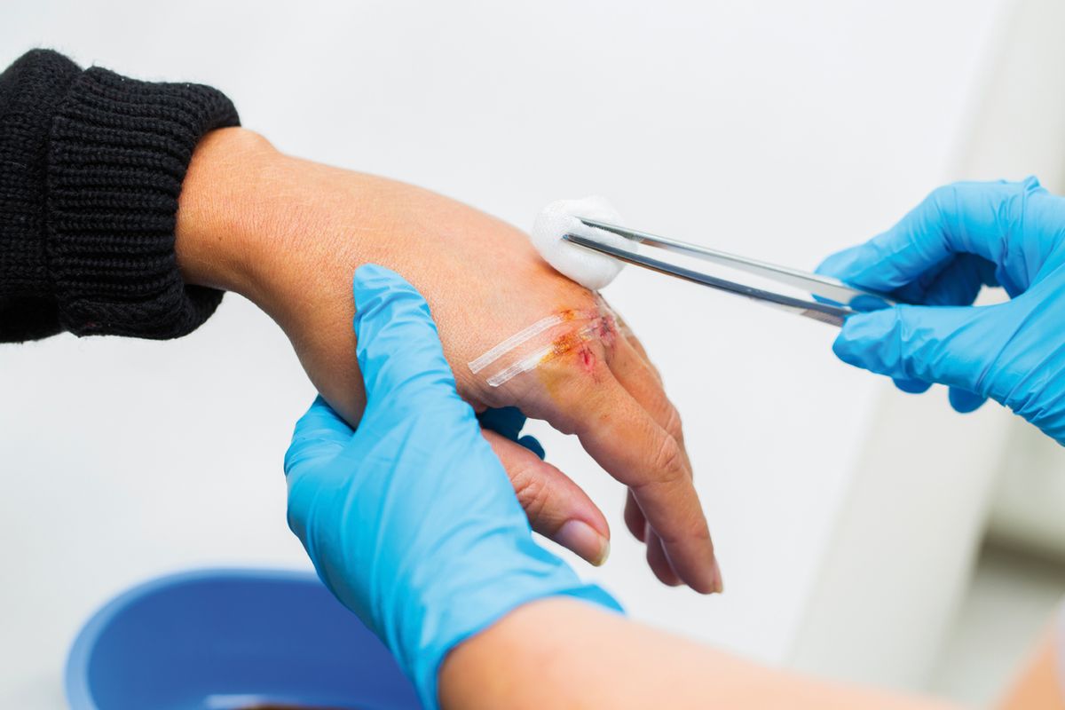 Is the slow wound healing due to the wrong dressing?