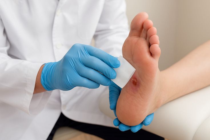 How should diabetic patients choose dressings for their wounds?