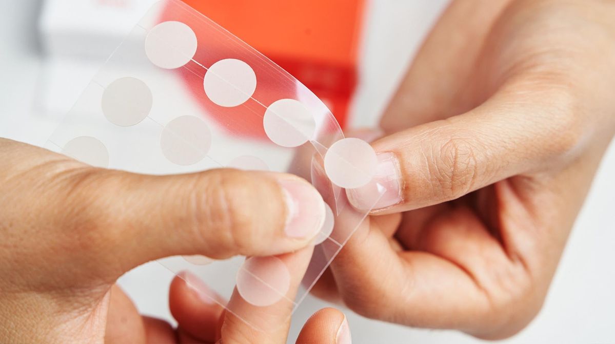 Can I use pimple patches after a pimple has popped?