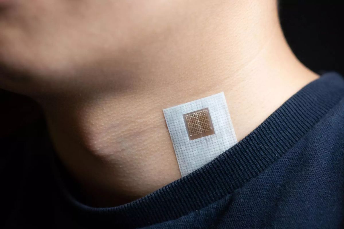 Are you familiar with smart wound dressings?