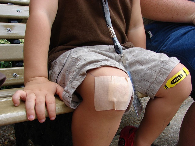 Does a scab forming on a wound really mean it's getting better?