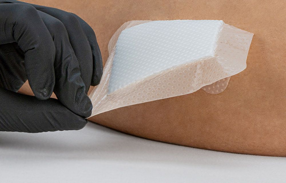 Will a suffocating dressing suffocate a wound?