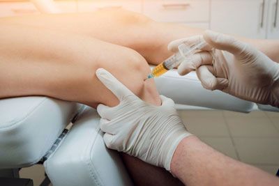 Scientists have developed a mineralized DNA hydrogel to accelerate bone repair.