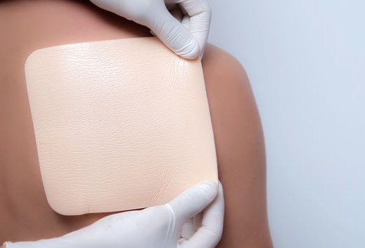 What should be done if an infection occurs after wound suturing?