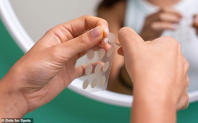 Should I squeeze out the pus from my pimple?