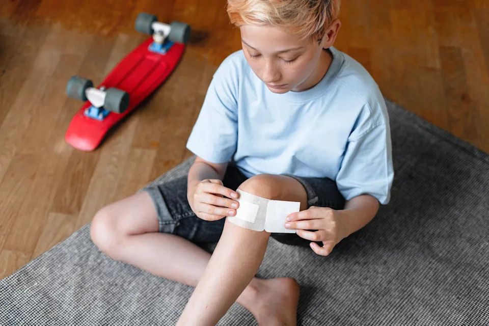 Treatment of acute skin trauma caused by sports