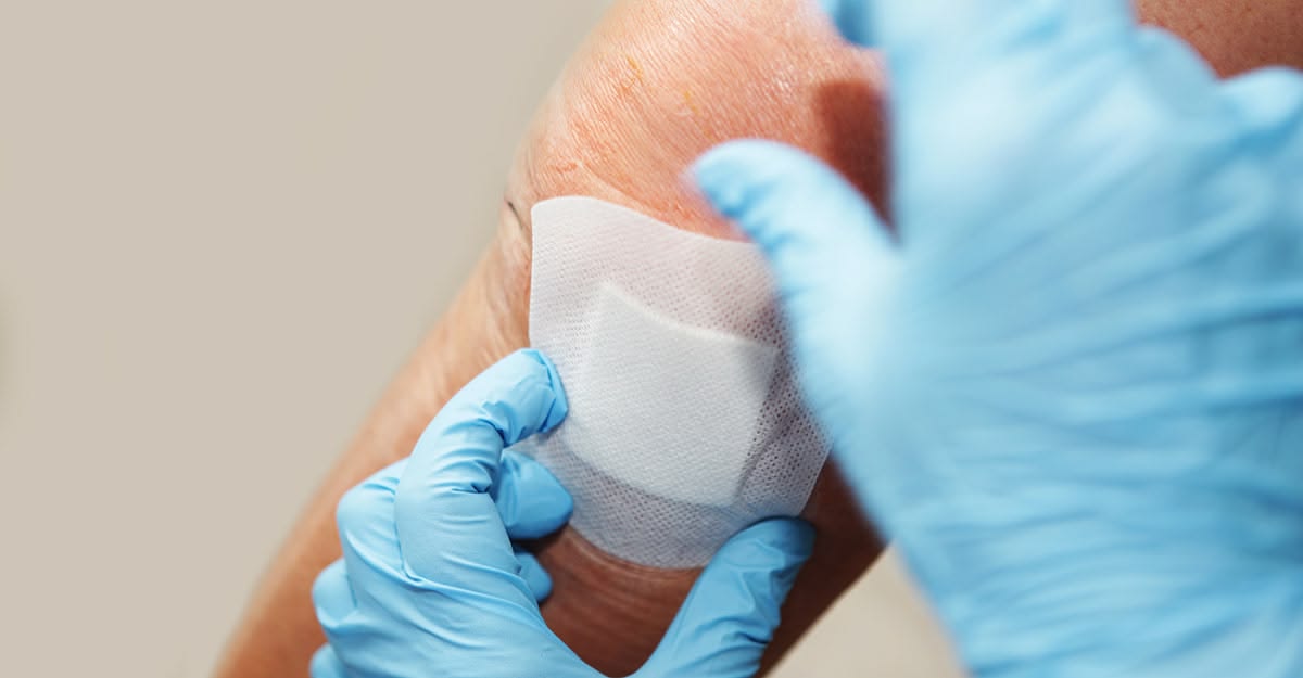 How can you tell if a wound is healing?