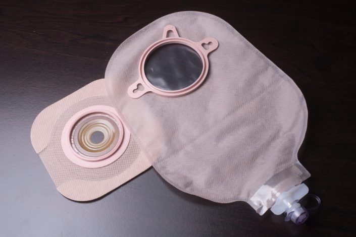 How to treat stoma leakage and skin redness?