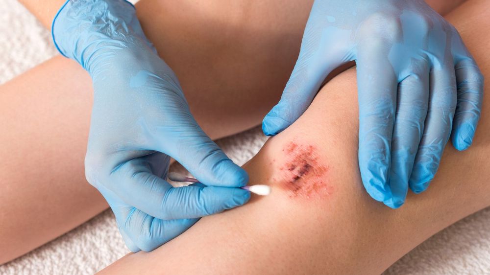 Is redness around a wound a normal healing reaction or an infection?