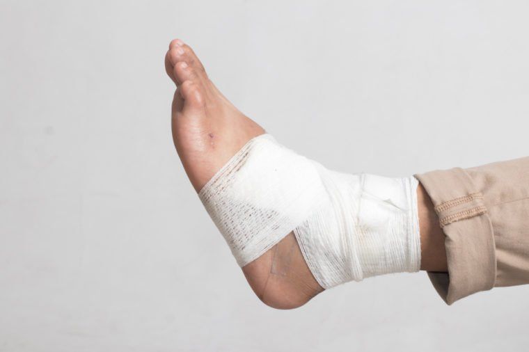 Is redness and swelling on the dorsum of the foot extending to the lower leg gangrene?