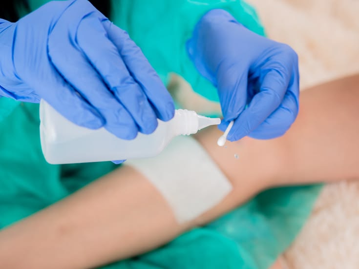 Does allowing the wound to breathe help it heal faster?